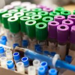 Глава ВОЗ не исключает версию лабораторного происхождения COVID-19